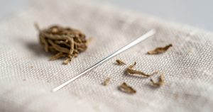 Acupuncture et Grossesse 2026 : Le Guide Complet des Bienfaits, du Déroulement et des Précautions