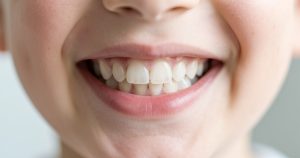 Taches dentaires chez l’enfant : causes et traitements